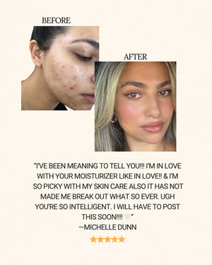 Breakouts and burnout 🐝