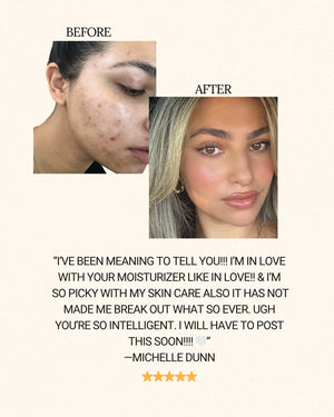 Royal Jelly Daily Moisturizer